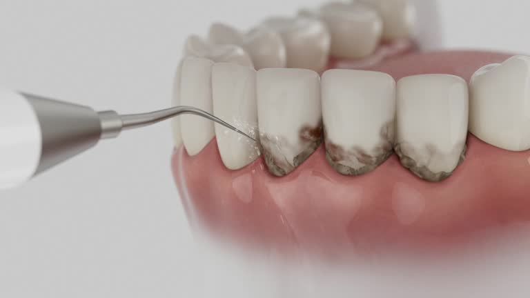 Trusted Dental Implants service in Pelican Marsh, FL - Dentist Open Now